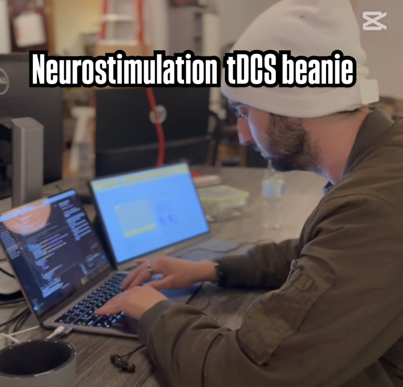 Thumbnail - Beanie Photo 2